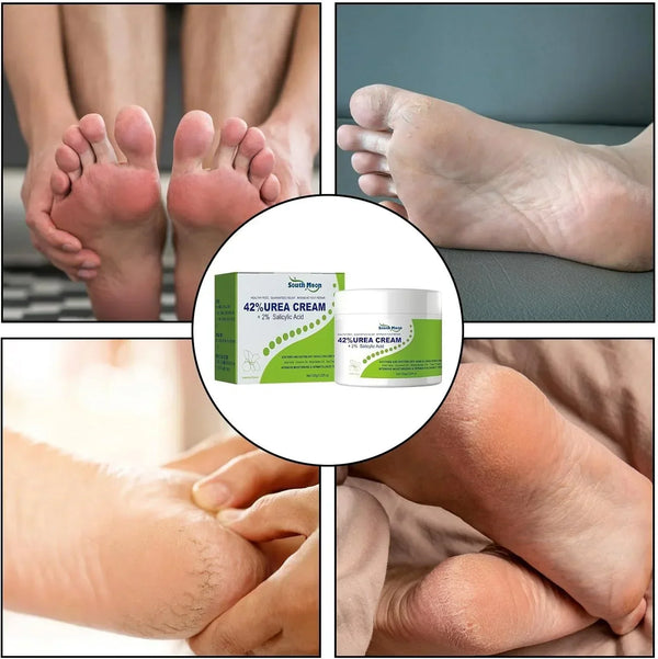 South Moon - 42% Urea Cream + 2% Salicylic Acid (Original)